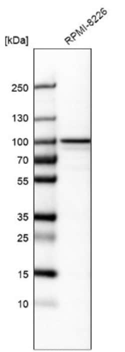 CCDC39 Antibody, Novus Biologicals 0.1mL; Unlabeled:Antibodies, Polyclonal